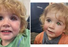 முத்தத்தால் குழந்தைக்கு கண் பார்வை பறிபோன பரிதாபம்!